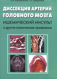 Диссекция артерий головного мозга: ишемический инсульт и другие клинические проявления: Монография