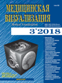 Нейровизуализационные характеристики изменений вещества головного мозга при генетической форме микроангиопатии (ЦАДАСИЛ)