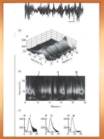 Использование вейвлет-преобразований для анализа электрической активности мозга при болезни Паркинсона 