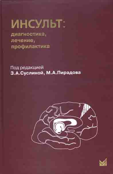 Инсульт: диагностика, лечение, профилактика